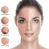 RF LED Skin Rejuvenator - Home Beauty Tool